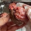 フランス風肉詰め【椎茸のファルシ】ジューシーなうまみの工程5